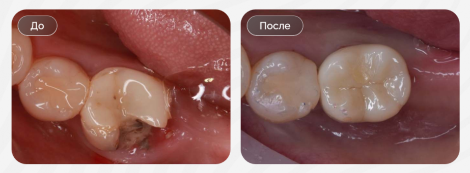 После